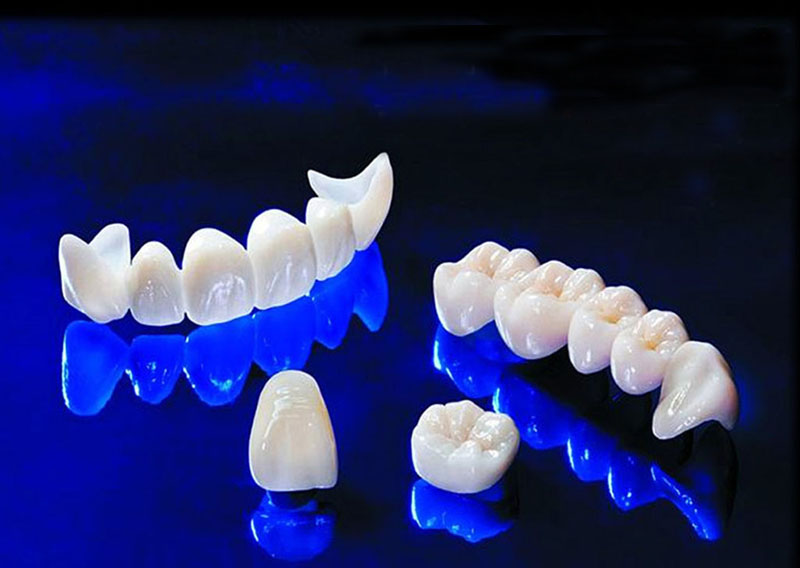 Dentartlab – Laboratorio Dental